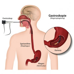 Gastroskopie, Magenspiegelung Wien